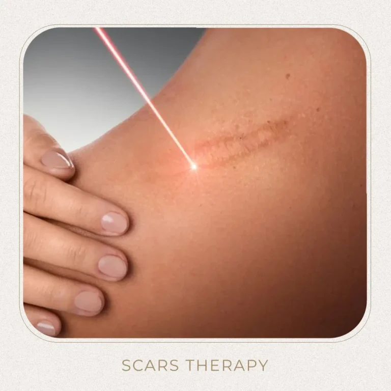 Scars Therapy