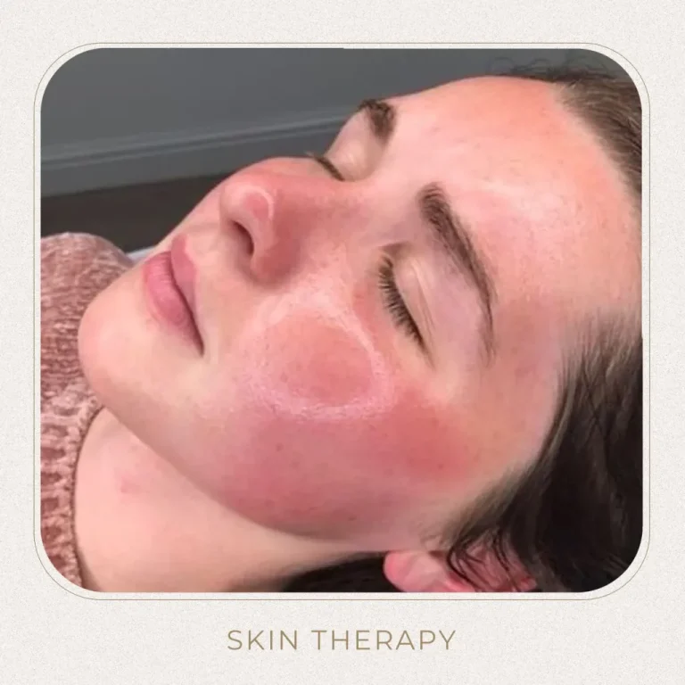 Skin Therapy