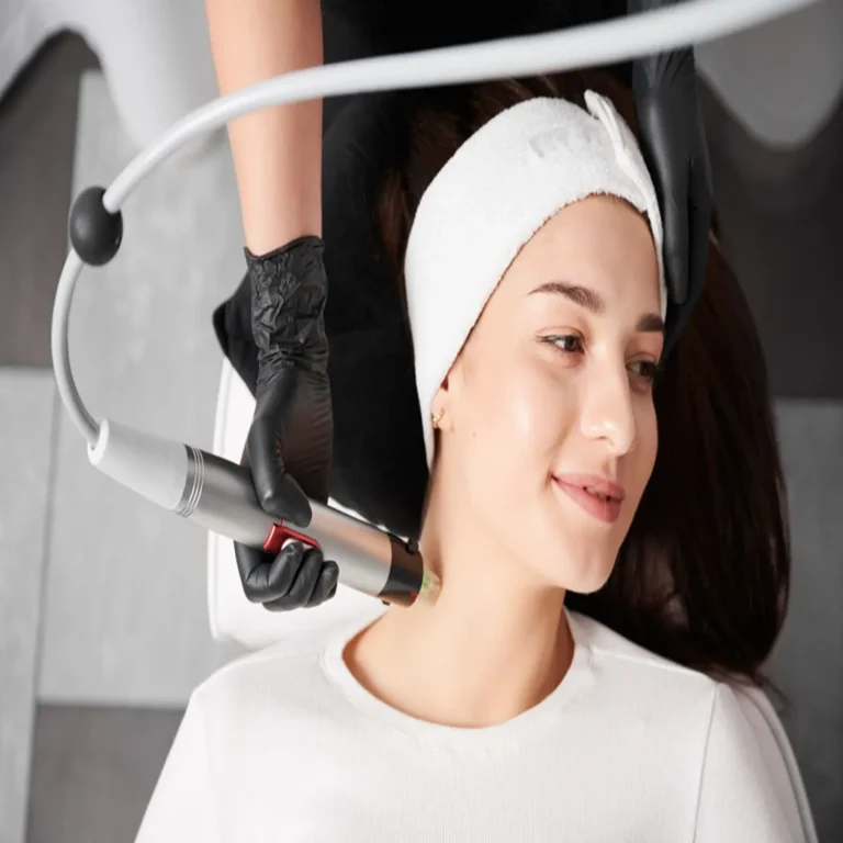 RF Microneedling